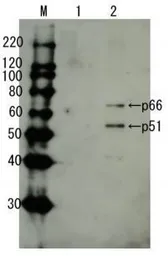 Anti-HIV1 Reverse transcriptase antibody used in Western Blot (WB). GTX64134