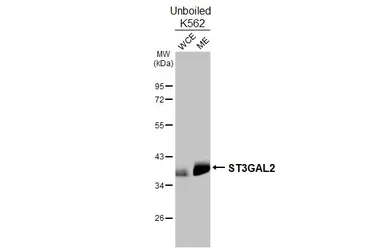Anti-ST3GAL2 antibody [HL3457] used in Western Blot (WB). GTX641342