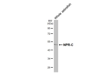 Anti-NPR-C antibody [HL3462] used in Western Blot (WB). GTX641347