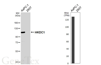Anti-HKDC1 antibody [HL3464] used in Western Blot (WB). GTX641349