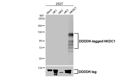 Anti-HKDC1 antibody [HL3464] used in Western Blot (WB). GTX641349