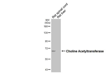 Anti-Choline Acetyltransferase antibody [HL3466] used in Western Blot (WB). GTX641351
