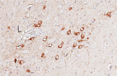 Anti-Choline Acetyltransferase antibody [HL3466] used in IHC (Paraffin sections) (IHC-P). GTX641351