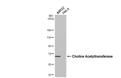 Anti-Choline Acetyltransferase antibody [HL3466] used in Western Blot (WB). GTX641351