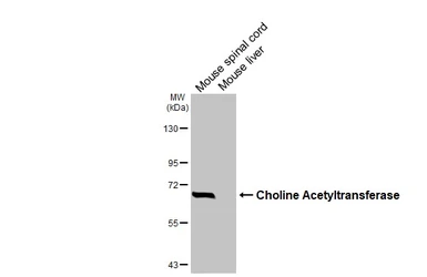 Anti-Choline Acetyltransferase antibody [HL3466] used in Western Blot (WB). GTX641351