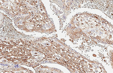 Anti-Choline Acetyltransferase antibody [HL3466] used in IHC (Paraffin sections) (IHC-P). GTX641351