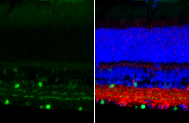 Anti-Choline Acetyltransferase antibody [HL3466] used in IHC (Paraffin sections) (IHC-P). GTX641351