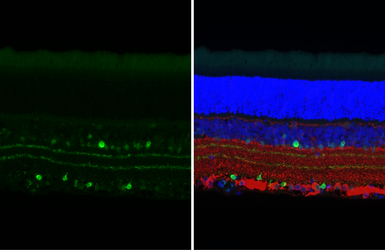 Anti-Choline Acetyltransferase antibody [HL3466] used in IHC (Paraffin sections) (IHC-P). GTX641351
