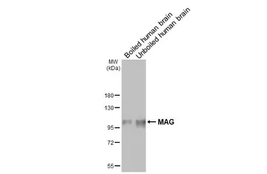 Anti-MAG antibody [HL3467] used in Western Blot (WB). GTX641352