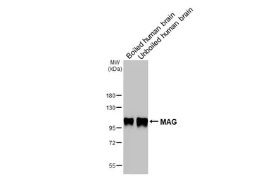 Anti-MAG antibody [HL3469] used in Western Blot (WB). GTX641354