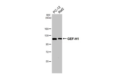 Anti-GEF-H1 antibody [HL3470] used in Western Blot (WB). GTX641355