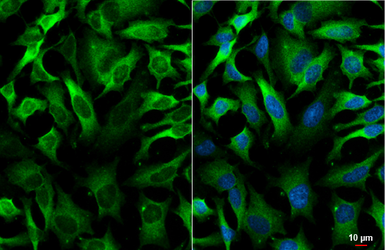 Anti-GEF-H1 antibody [HL3470] used in Immunocytochemistry/ Immunofluorescence (ICC/IF). GTX641355