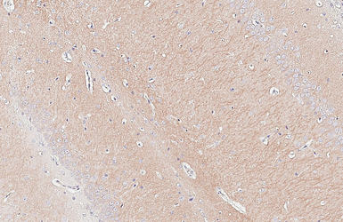 Anti-GEF-H1 antibody [HL3470] used in IHC (Paraffin sections) (IHC-P). GTX641355