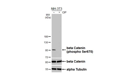 Anti-beta Catenin (phospho Ser675) antibody [HL3471] used in Western Blot (WB). GTX641356