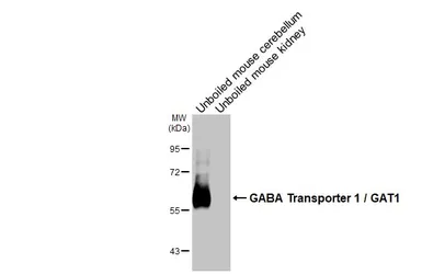 Anti-GABA Transporter 1 / GAT1 antibody [HL3475] used in Western Blot (WB). GTX641360