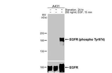 Anti-EGFR (phospho Tyr974) antibody [HL3480] used in Western Blot (WB). GTX641365