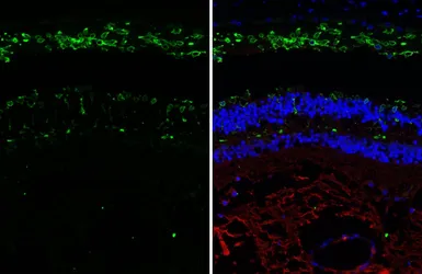 Anti-Opsin Red / Green antibody [HL3484] used in IHC (Paraffin sections) (IHC-P). GTX641369