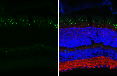 Anti-Opsin Red / Green antibody [HL3484] used in IHC (Paraffin sections) (IHC-P). GTX641369