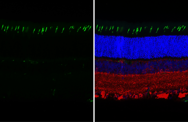 Anti-Opsin Red / Green antibody [HL3484] used in IHC (Paraffin sections) (IHC-P). GTX641369