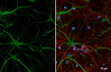 Anti-GFAP antibody [GT51] used in Immunocytochemistry/ Immunofluorescence (ICC/IF). GTX641375