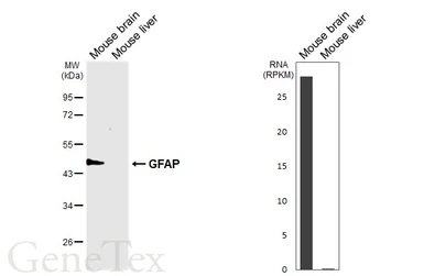 Anti-GFAP antibody [GT51] used in Western Blot (WB). GTX641375