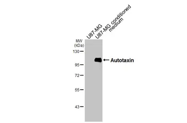 Anti-Autotaxin antibody [HL3488] used in Western Blot (WB). GTX641376