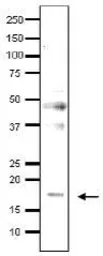 Anti-Med9 / Cse2 (S. cerevisiae) antibody used in Western Blot (WB). GTX64138