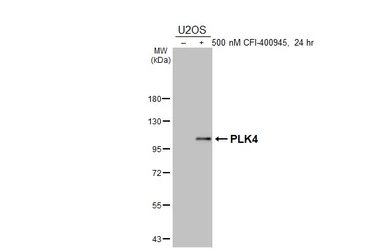 Anti-PLK4 antibody [HL3493] used in Western Blot (WB). GTX641381
