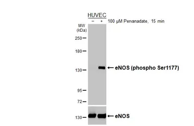Anti-eNOS (phospho Ser1177) antibody [HL3498] used in Western Blot (WB). GTX641386