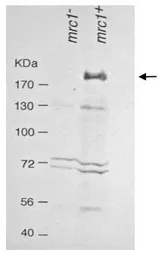Anti-Mrc1 (S. pombe) antibody used in Western Blot (WB). GTX64139