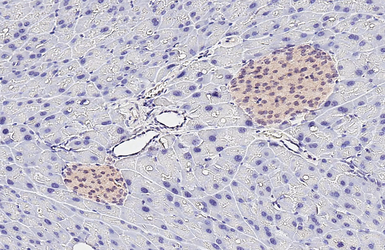 Anti-PLCG1 antibody [HL3507] used in IHC (Paraffin sections) (IHC-P). GTX641395