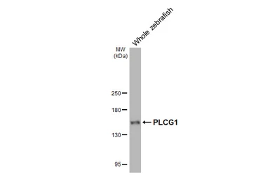 Anti-PLCG1 antibody [HL3508] used in Western Blot (WB). GTX641396