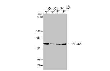 Anti-PLCG1 antibody [HL3508] used in Western Blot (WB). GTX641396