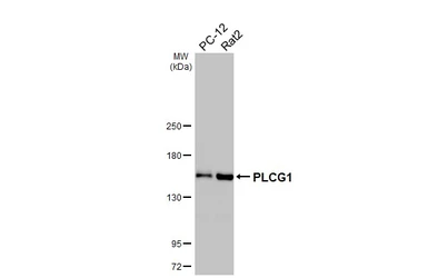 Anti-PLCG1 antibody [HL3508] used in Western Blot (WB). GTX641396