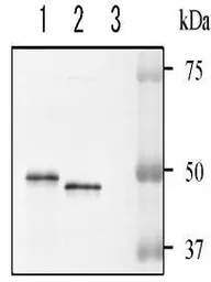 Anti-NADase antibody used in Western Blot (WB). GTX64140