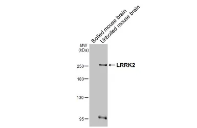 Anti-LRRK2 antibody [GT53] used in Western Blot (WB). GTX641405