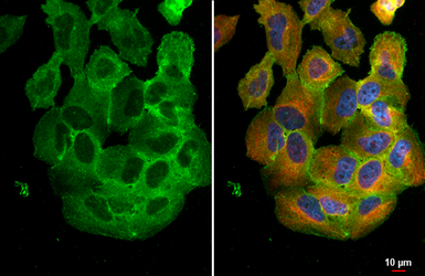 Anti-LRRK2 antibody [GT53] used in Immunocytochemistry/ Immunofluorescence (ICC/IF). GTX641405