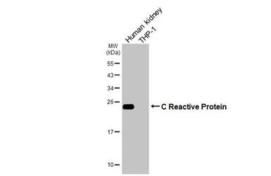 Anti-C Reactive Protein antibody [GT54] used in Western Blot (WB). GTX641406