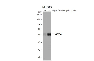 Anti-ATF4 antibody [HL3514] used in Western Blot (WB). GTX641411