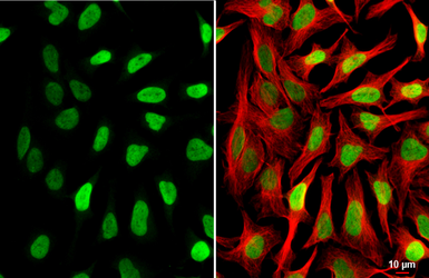 Anti-Histone H2A.X antibody [HL3515] used in Immunocytochemistry/ Immunofluorescence (ICC/IF). GTX641412