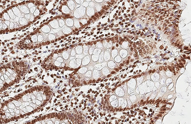 Anti-Histone H2A.X antibody [HL3515] used in IHC (Paraffin sections) (IHC-P). GTX641412