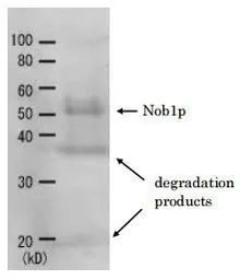 Anti-Nob1 (S. cerevisiae) antibody used in Western Blot (WB). GTX64142