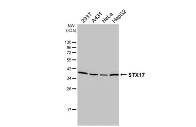 Anti-STX17 antibody [HL3534] used in Western Blot (WB). GTX641431