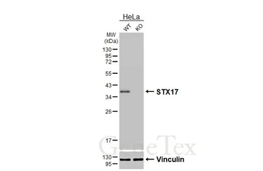 Anti-STX17 antibody [HL3534] used in Western Blot (WB). GTX641431