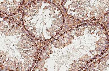 Anti-STX17 antibody [HL3534] used in IHC (Paraffin sections) (IHC-P). GTX641431