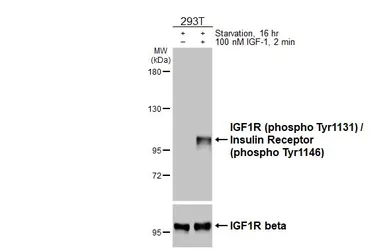 Anti-IGF1R beta (phospho Tyr1131) / Insulin Receptor beta (phospho Tyr1146) antibody [HL3537] used in Western Blot (WB). GTX641434