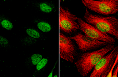 Anti-Exonuclease 1 antibody [HL3547] used in Immunocytochemistry/ Immunofluorescence (ICC/IF). GTX641453