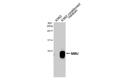 Anti-NMU antibody [HL3549] used in Western Blot (WB). GTX641455