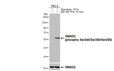 Anti-SMAD2 (phospho Ser245/Ser250/Ser255) antibody [HL3555] used in Western Blot (WB). GTX641461