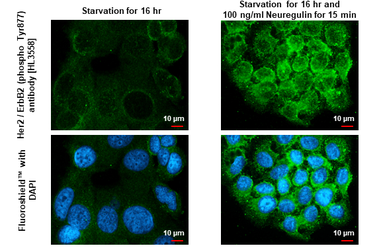 Anti-Her2 / ErbB2 (phospho Tyr877) antibody [HL3558] used in Immunocytochemistry/ Immunofluorescence (ICC/IF). GTX641464